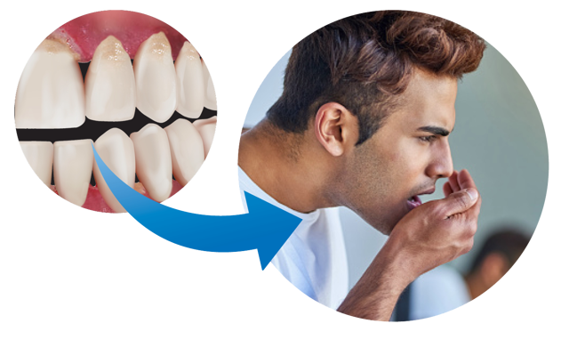 Figure 8A Gum Disease And Halitosis