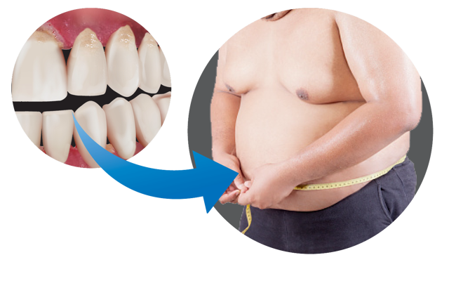 Figure 6E Gum Disease And Obesity