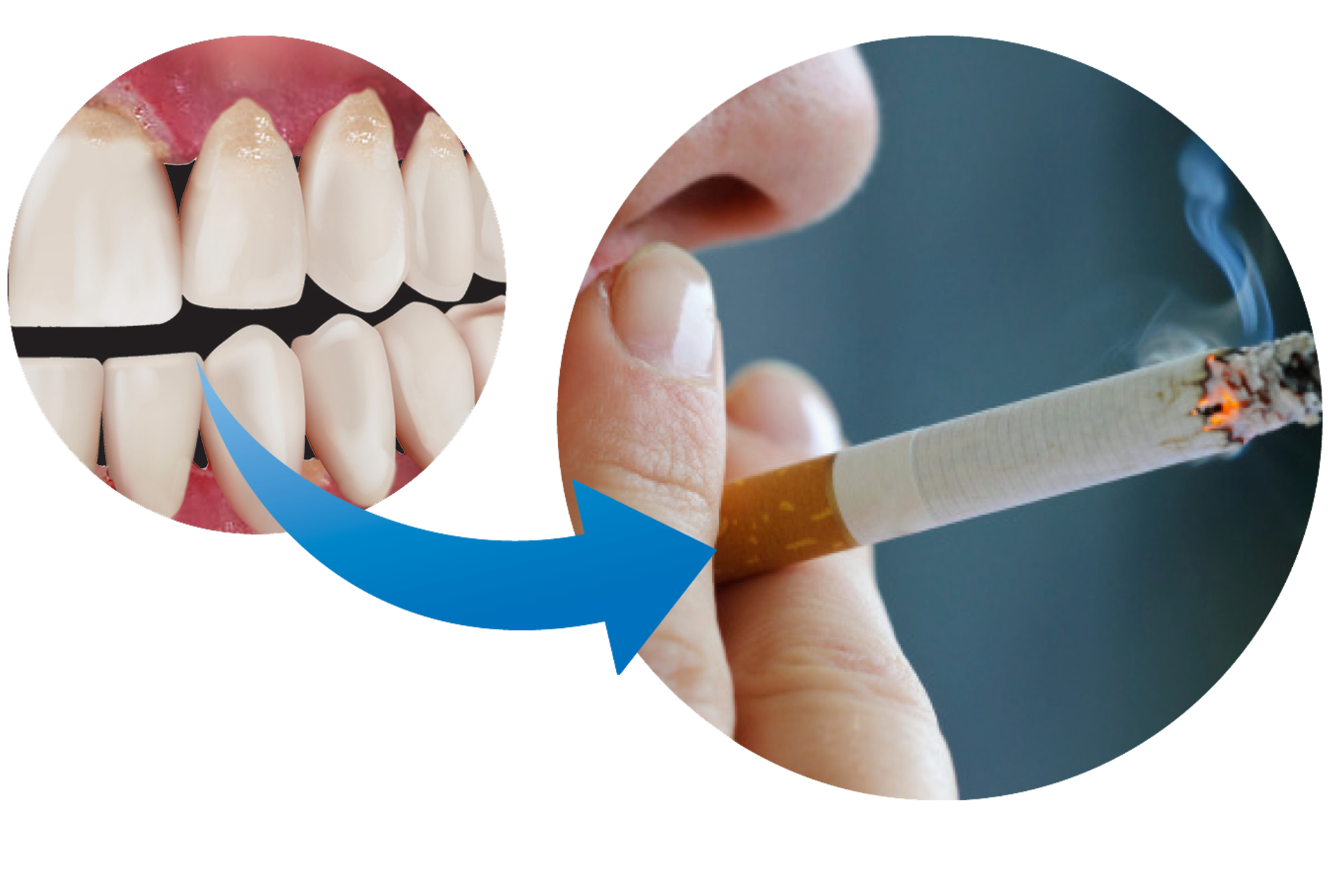 Figure 7 Gum Disease And Smoking
