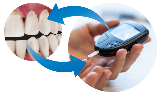 Figure 5 Gum Disease And Diabetes