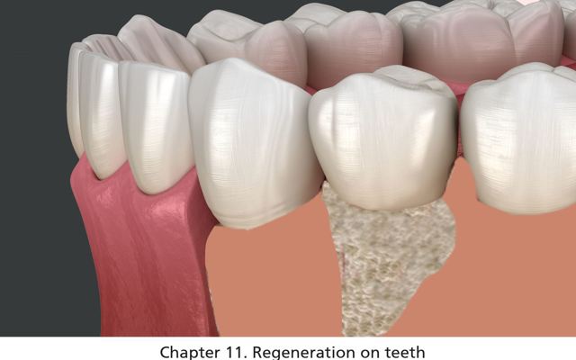 Figure 11A Regeneration On Teeth